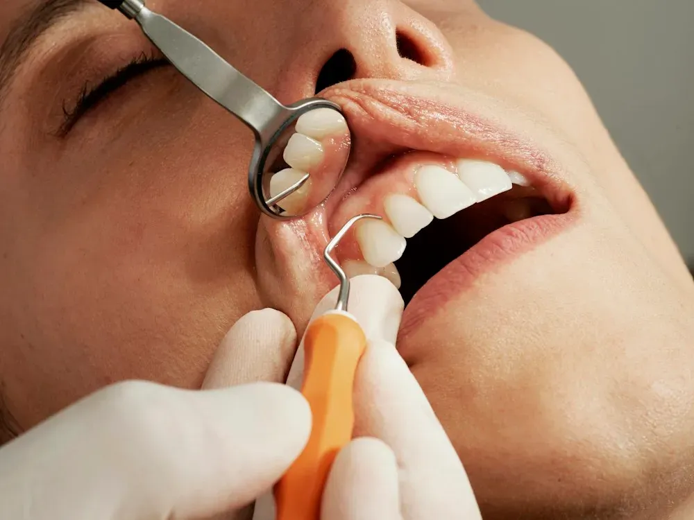 Limpieza dental en consulta